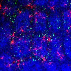 【01. 脳に広がる宇宙:Sparse labeling of cortical neurons】
体性感覚野神経細胞をエレクトロポレーション法で蛍光標識した画像になります。疎らに標識されている細胞を星(緑、赤)、VGluT2抗体で標識された視床皮質軸索終末(青)を星雲として見ることで、作品名に宇宙を加えました。色は変更可能です。