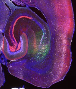 【02. 腹側海馬体時代の夜明け】
これまで海馬体研究は背側の解析が中心でした。しかし、これからは「腹側海馬体」の時代です!動物の情動記憶はヒトのエピソード記憶に近いと言われますが、扁桃体や側坐核など、いわゆる「情動脳」に投射するニューロン(緑)がマウス腹側海馬体の特定の領域に局在していました。ZnT3(赤)、calbindin(白)等の複数の抗体反応を組み合わせて作成した新しい海馬体地図に照らし合わせると、それらのニューロンの分布を正確に把握することができました。記憶や認知症の研究にとって、腹側海馬体は無視することのできない重要な脳領域です。新海馬体地図を片手に、未知の大陸・腹側海馬体の探求に乗り出しましょう。この写真を見ていると、銀河の海に漕ぎ出していくような気分になってきませんか?