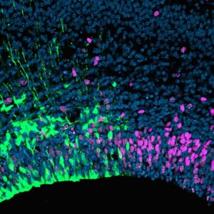 【09. モーター分子の機能不全による神経幹細胞の増殖低下】
モーター分子Kif23の脳発生における機能解析を行うため、マウス胎齢14.5日の脳原基にKif23のsiRNAを注入し、子宮内電気穿孔法を用いて、神経幹細胞におけるKif23のノックダウン実験を行った。GFPが共導入された Kif23機能阻害領域(緑色)を境に、細胞周期のS期を標識するEdU陽性細胞(赤色)が減少し、Kif23機能阻害により神経幹細胞の増殖が低下したことが明らかになった。