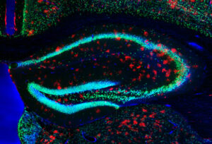 【10. 星の記憶 ― Astrocytes in the Hippocampus】
マウス尾静脈より投与したAAVにより、海馬アストロサイトにmCherryを特異的に発現させた。NeuN染色により可視化されたニューロンと、赤く輝きを放つアストロサイトが織りなす構造は、記憶形成に関与する神経回路の精緻な配置を示している。